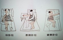 【康復(fù)專欄】卒中后康復(fù)， 您了解多少