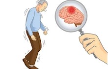  老患者突發(fā)腦血管意外，中醫(yī)院靜脈溶栓打開“生命之路”